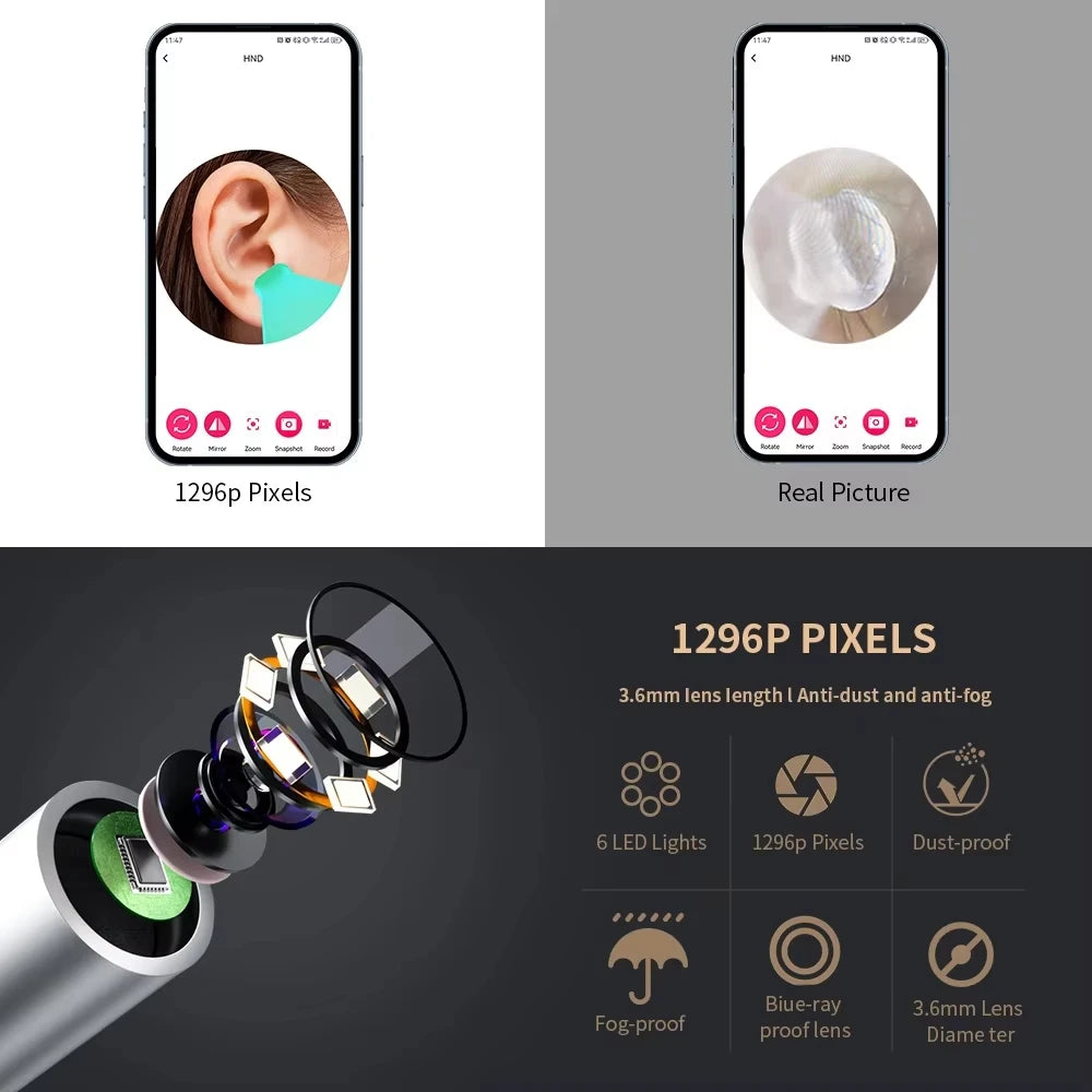 Ear Cleaner with Camera 1296P Ear Sticks USB C Charging Ear Wax Removal Tool WIFI Connection 6 LED Lights